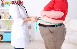 Лечение ожирения в Испании